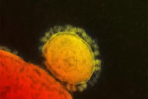 Das Foto zeigt den Coronavirus unter dem Elektronenmikroskop.
