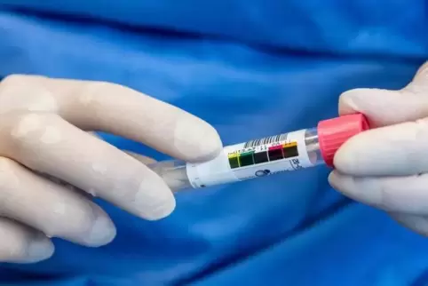 Nach dem Abstrich bei einem Patienten wird diese Probe in einem Labor auf eine mögliche Infektion mit dem Coronavirus untersucht