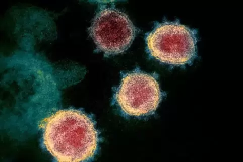 Das Problem: Eine Aufnahme aus dem Elektronenmikroskop zeigt Viren vom Typ SARS-CoV-2, oder kurz, das neuartige Coronavirus. 