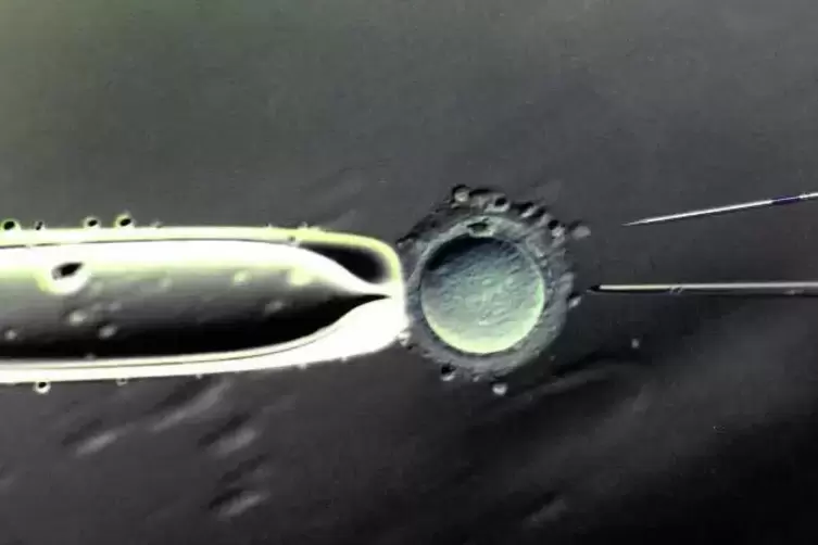 Befruchtung einer Eizelle mit einer Injektionspipette .