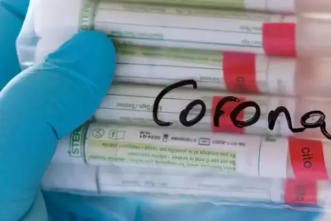 Wer positiv auf das neue Coronavirus getestet wurde, geht in die offizielle Fallstatistik ein.