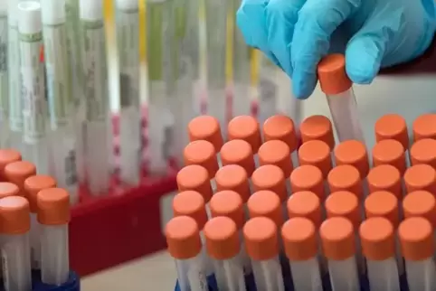 Proben für Corona-Tests werden für die weitere Untersuchung vorbereitet. 