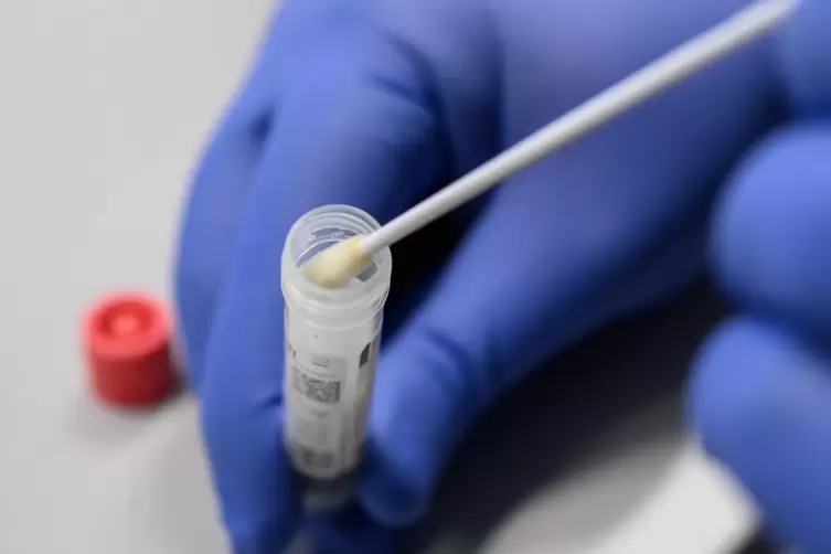 Für das Testverfahren auf das Virus Sars-Cov-2 nehmen Mediziner zunächst einen Abstrich aus dem Rachenraum.