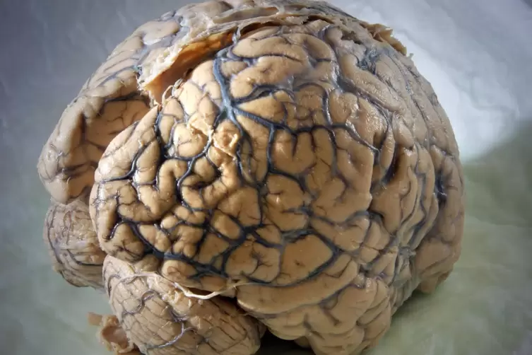 Ein Gehirn des Menschen: Armin Grau erklärt in seinem Buch auch die Funktionsweise der einzelnen Bereiche des Gehirns.