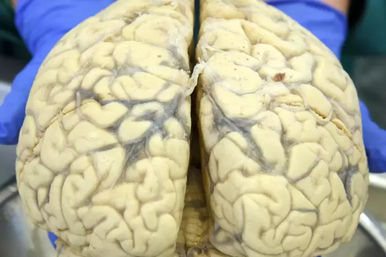 Im menschlichen Gehirn vollziehen sich komplexe Abläufe, die auch Forscher immer wieder fasznieren. 