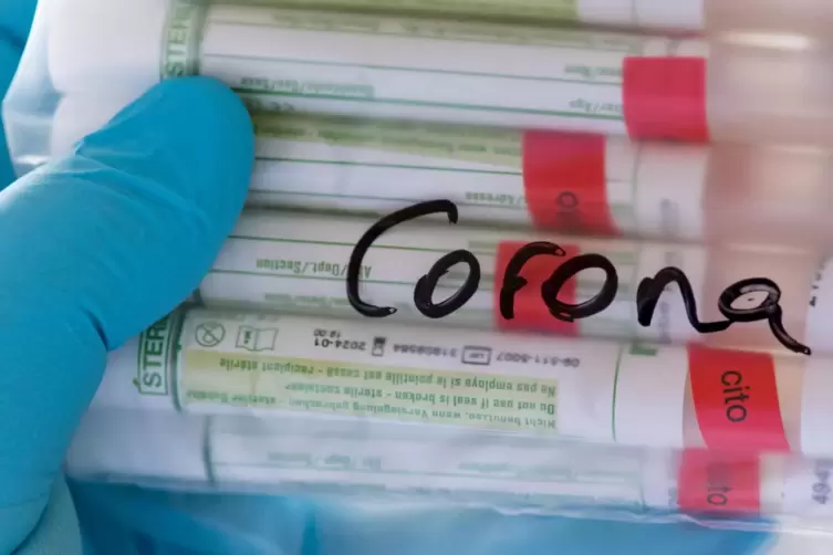 Proberöhrchen für Coronavirus-Tests.