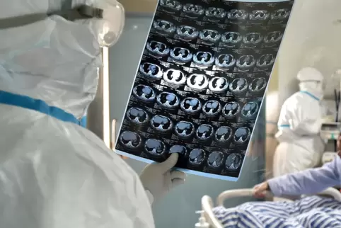 Ein Arzt begutachtet CT-Bilder eines Patienten mit einer durch den Coronavirus ausgelösten Lungenentzündung. 