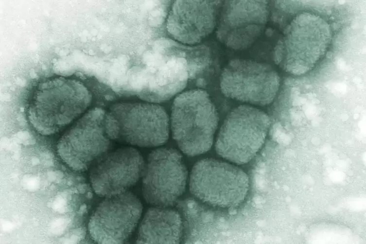 Menschliche Pockenviren unter dem Transmissionselektronenmikroskop. 