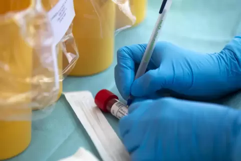 Der Verstorbene soll an Vorerkrankungen gelitten haben. 