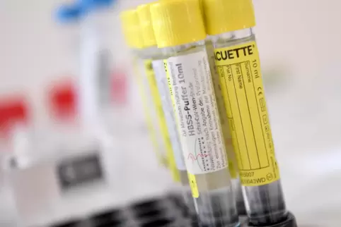 Die Kosten für die Tests bei Erzieher übernimmt das Land, teilte das Gesundheitsamt Kaiserslautern am Montag mit. 
