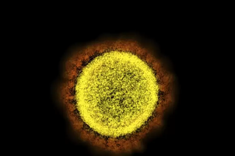 Das Coronavirus unter dem Elektronenmikroskop. 