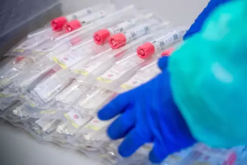 Testsets mit Abstrichstäbchen werden weiterhin in großer Zahl gebraucht. 