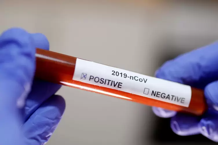 2020-03-09t184428z_178318064_rc2igf9js79u_rtrmadp_3_health-coronavirus-who