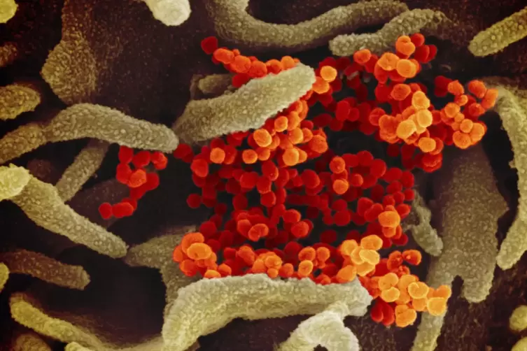 Eine undatierte elektronenmikroskopische Aufnahme des US National Institute of Health zeigt das Coronavirus (orange), das aus de