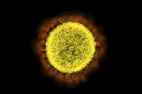Das Coronavirus unter dem Elektronenmikroskop.