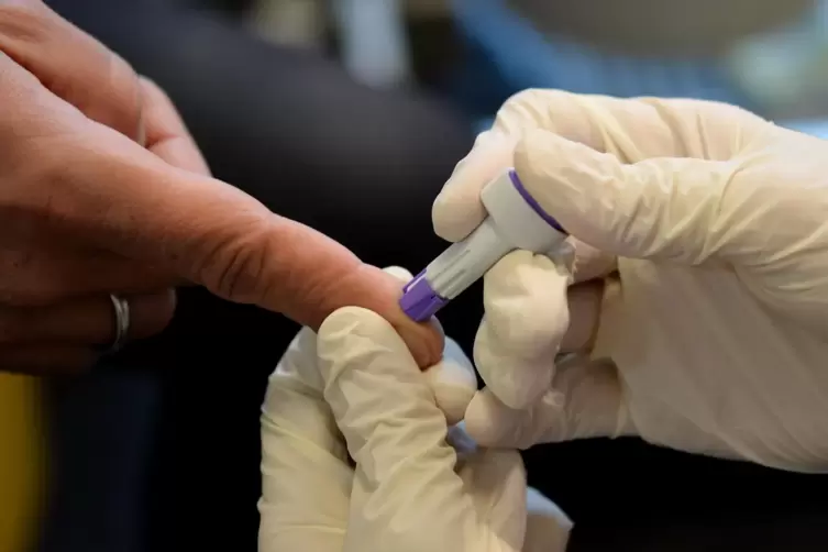 Bei Aids-Tests werden aus einigen Regionen Engpässe gemeldet.