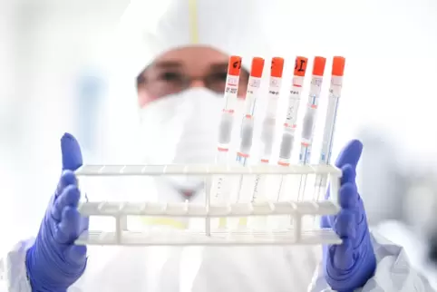 Fünf Prozent der Abstriche von Infizierten werden seit vergangener Woche auf Virus-Mutationen untersucht.
