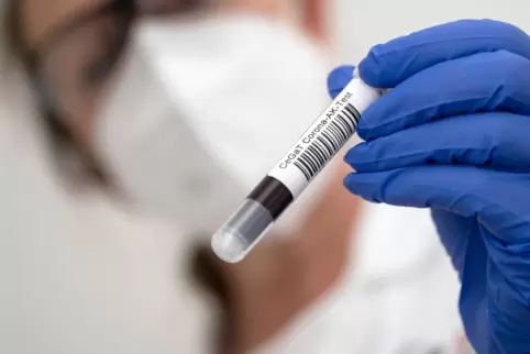 Erstmals wird die mutierte Virus-Variante auch in Rheinland-Pfalz nachgewiesen. 