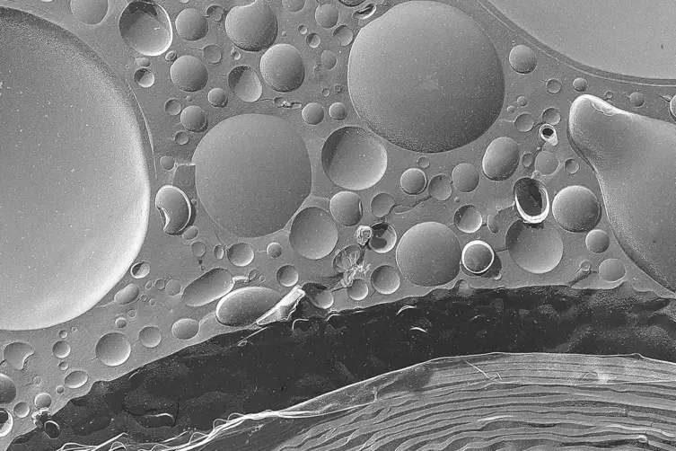Eine elektronenmikroskopische Ansicht der Lamellenstruktur von Liposomen, winzige Fettkügelchen, in die zum Beispiel Arzneiwirks