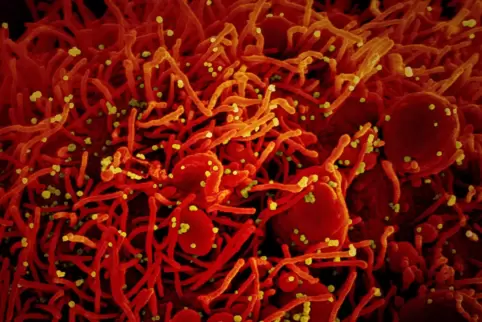 Auf dieser von einem US-Forschungszentrum zur Verfügung gestellten Aufnahme ist eine Zelle zu sehen, die mit dem Coronavirus (ge