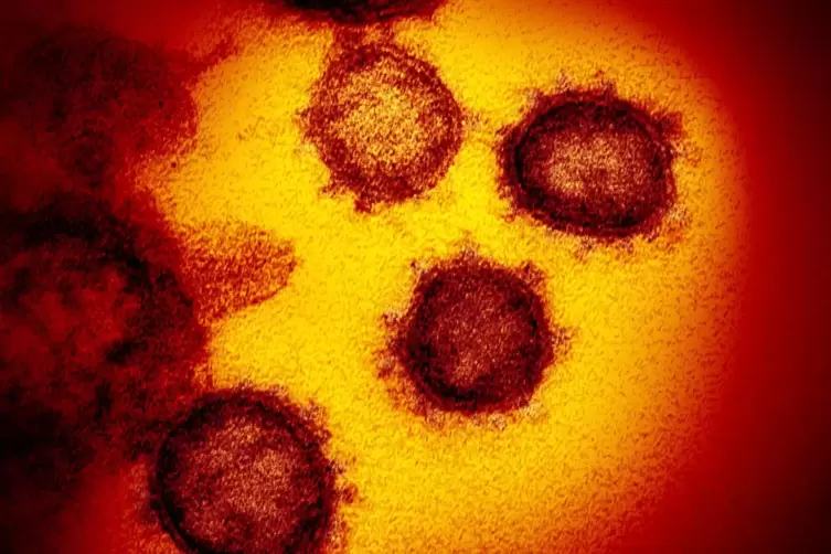 33 neue Infektionen mit dem Virus wurden am Samstag gemeldet. 