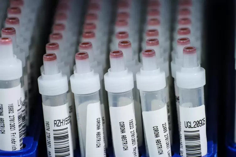 Kunststoffröhrchen mit Corona-Abstrichen nach einem PCR-Test in einem Labor.