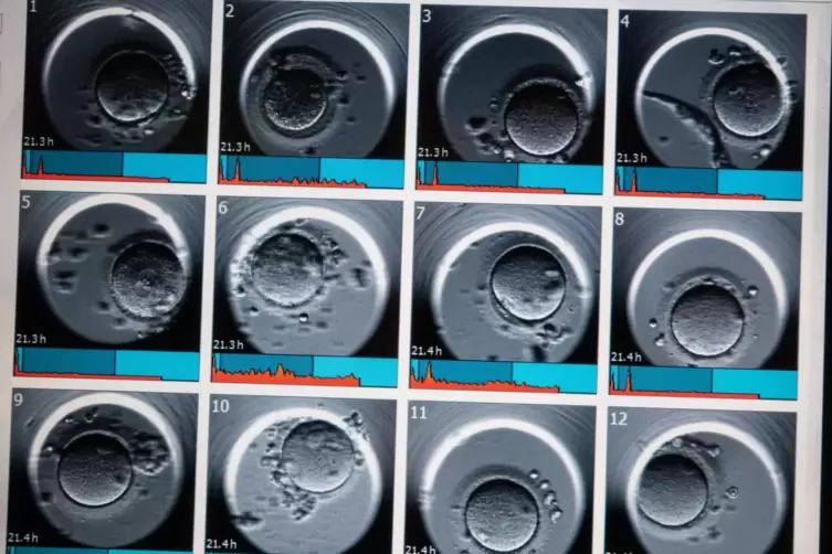 Auf einem Monitor sind Aufnahmen von Embryonen zu sehen.