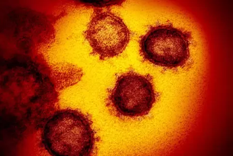 Die vom National Institute of Allergy and Infectious Diseases in den USA zur Verfügung gestellte Aufnahme zeigt das Coronavirus 