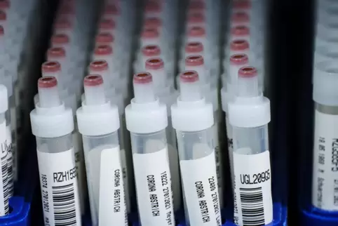 Röhrchen mit Corona-Abstrichen stehen nach dem PCR-Test in einem Labor. 