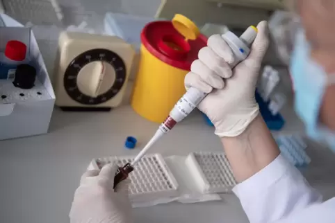 Eine Mitarbeiterin des baden-württembergischen Landesgesundheitsamts untersucht eine Blutprobe auf Antikörper. 