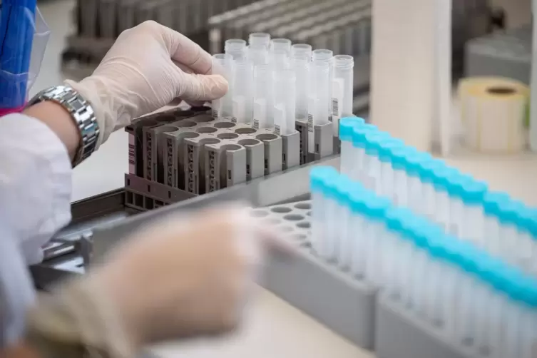 Eine Mitarbeiterin bereitet in einem Labor Teströhrchen für einen PCR-Test vor. 