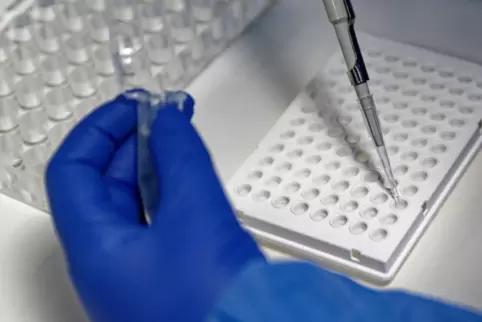 Engpässe: PCR-Test. Engpässe: PCR-Test.