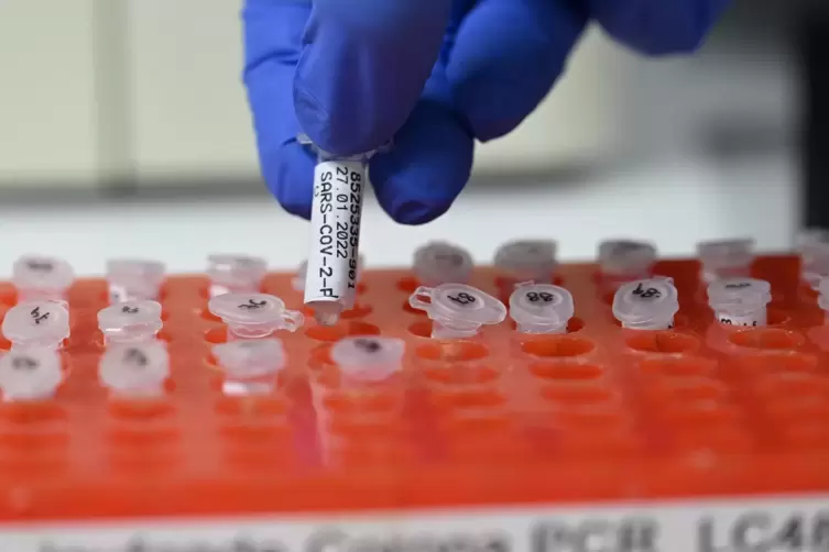 In einem Testlabor werden PCR-Tests vorbereitet. 