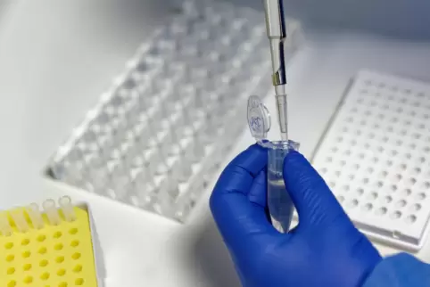 Laborvorbereitung auf einen PCR-Test. 