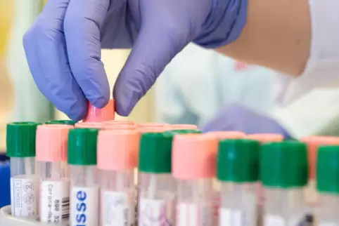 Die Labore haben mit der Auswertung der PCR-Tests alle Hände voll zu tun.