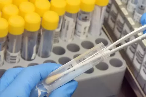 373 positive Corona-Tests meldeten die Labore am Mittwoch dem Gesundheitsamt.