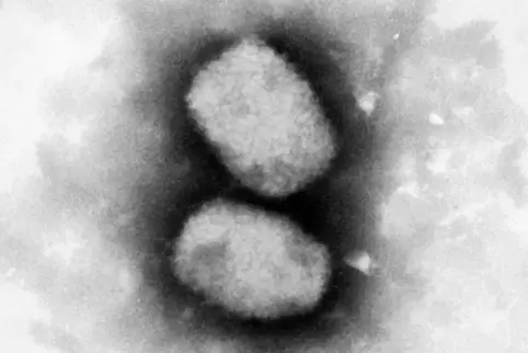 Diese vom Robert Koch-Institut (RKI) zur Verfügung gestellte elektronenmikroskopische Aufnahme zeigt das Affenpockenvirus.