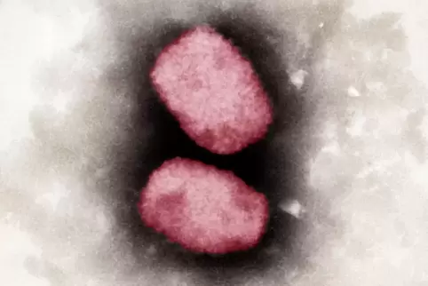 Elektronenmikroskopische Aufnahme von Affenpocken-Viren. 
