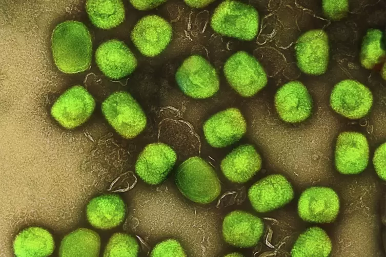  Eine kolorierte Aufnahme von Partikeln des Affenpockenvirus