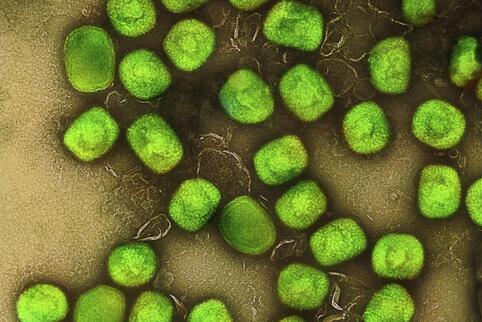  Eine kolorierte Aufnahme von Partikeln des Affenpockenvirus