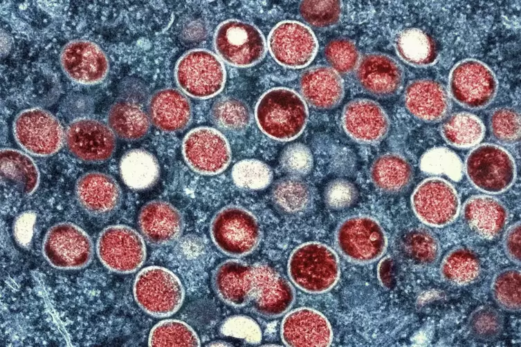  Eine kolorierte transmissionselektronenmikroskopische Aufnahme von Partikeln des Affenpockenvirus (rot) in einer infizierten Ze