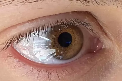 Bei Rötung, Fremdkörpergefühl und Schmerzen im Auge ist Vorsicht geboten. 