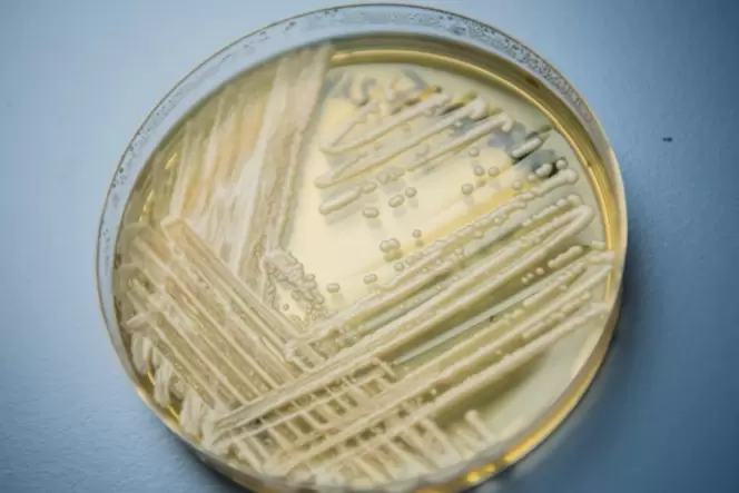 Der weltweit auftretende Hefepilz Candida auris in einer Petrischale, aufgenommen in einem Universitätslabor. Er kann leicht per