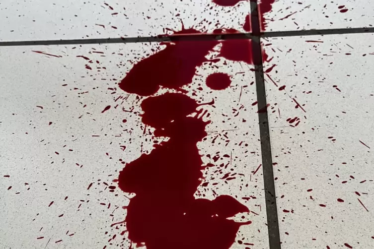 Eine scheinbar harmlose Bisswunde kann gro&szlig;en Blutverlust nach sich ziehen. 