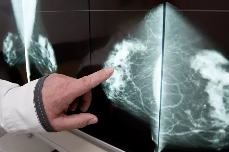 Auff&auml;lligkeiten an der weiblichen Brust sind per Mammographie zu finden. 