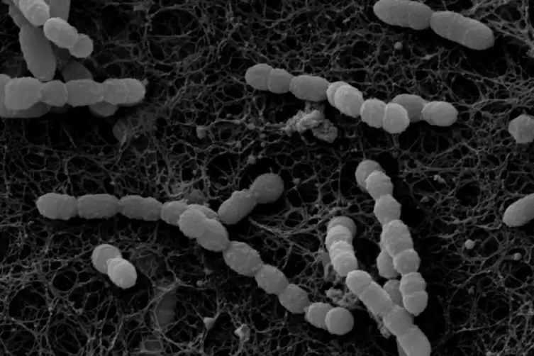 B&uuml;hne frei f&uuml;r Bakterien im Wein: Rasterelektronenmikroskopische Aufnahme von Oenococcus oeni. 