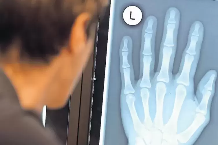 Eine Möglichkeit zur Altersfeststellung: das Röntgen der Hand.