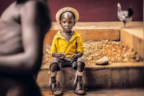 Das Foto von Antonio Aragón Renuncios zeigt einen Jungen aus Togo mit Beinprothesen.