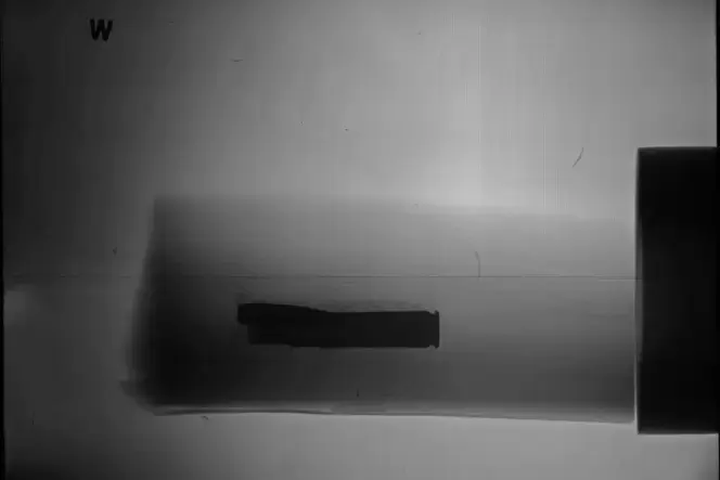 Mörderische Falle: Das Röntgenbild zeigt die Sprengladung in einem Holzscheit, das die Polizei in Fischbach gefunden hat. Sie ge