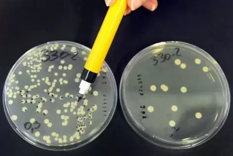 Hefebakterien in Petri-Schalen. Foto: Peter Zschunke/dpa